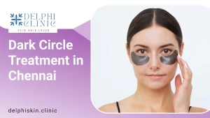 Dark circle treatment in Chennai