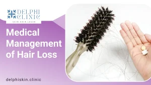 Medical Management of Hair Loss | Delphi Skin Clinic
