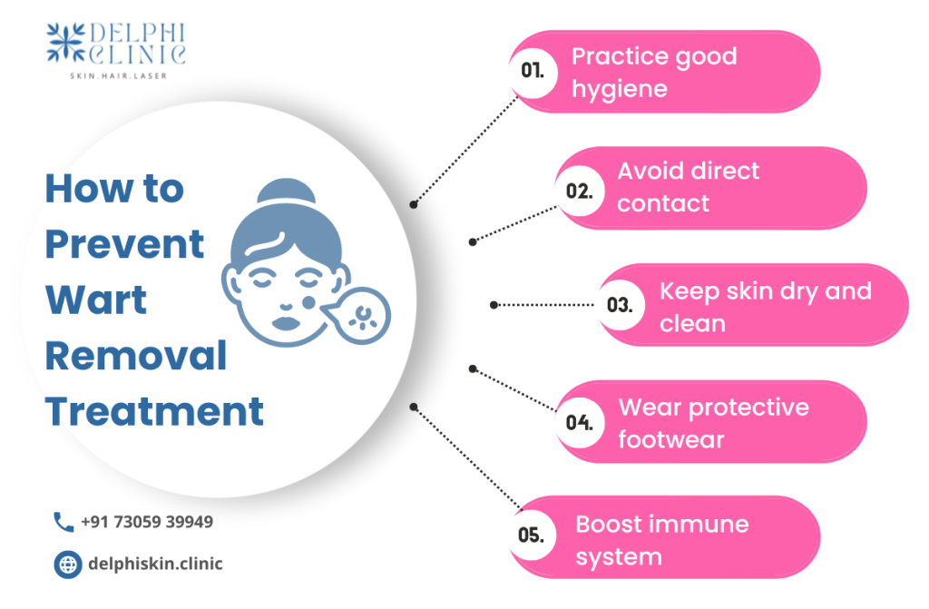 Warts Removal Treatment in Anna Nagar 1 Warts Removal Treatment in Anna Nagar