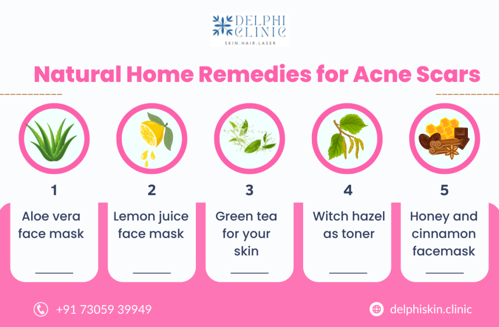 Pimple Scar Treatment in Chennai 1 Pimple Scar Treatment in Chennai